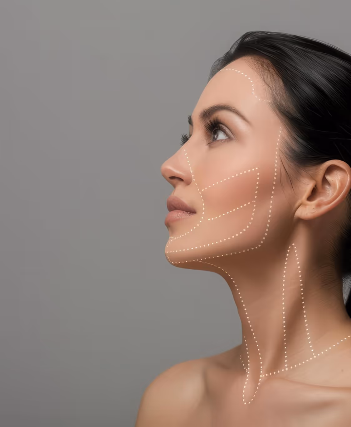 Profile of a woman with dotted lines on face and neck indicating cosmetic or medical treatment areas.