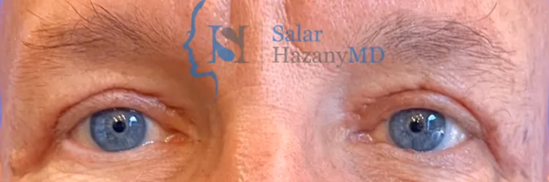 Close-up of a man's blue eyes and eyebrows with aged skin and a blue background.
