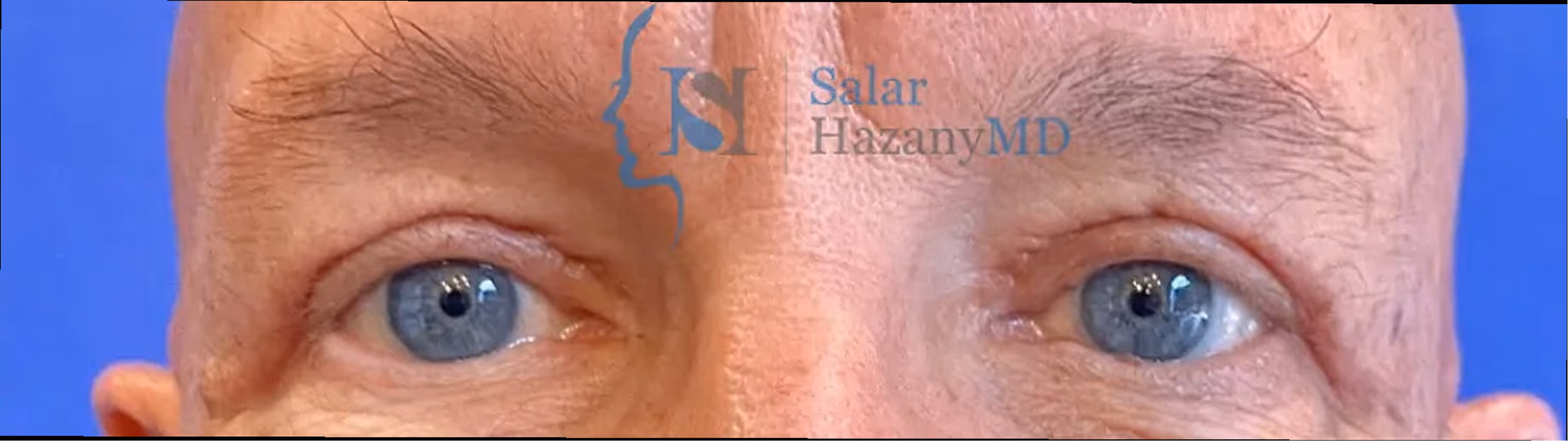 Close-up of a man's blue eyes and eyebrows with aged skin and a blue background.
