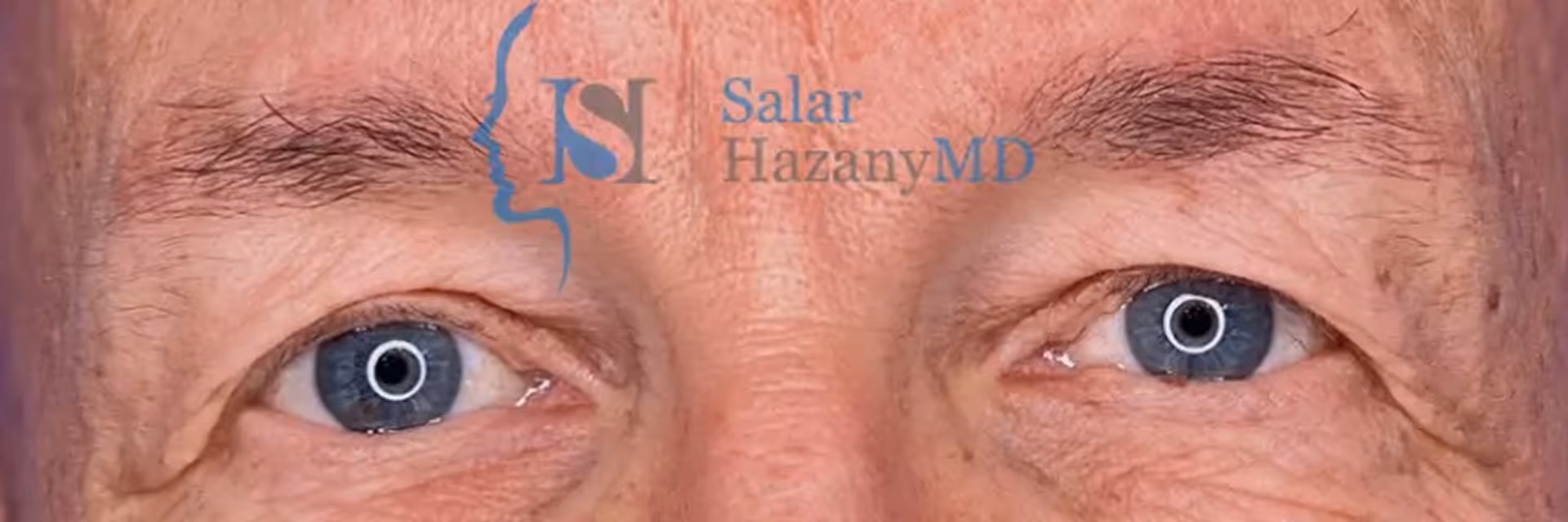 Close-up of an older man's blue eyes with visible wrinkles and blue background.