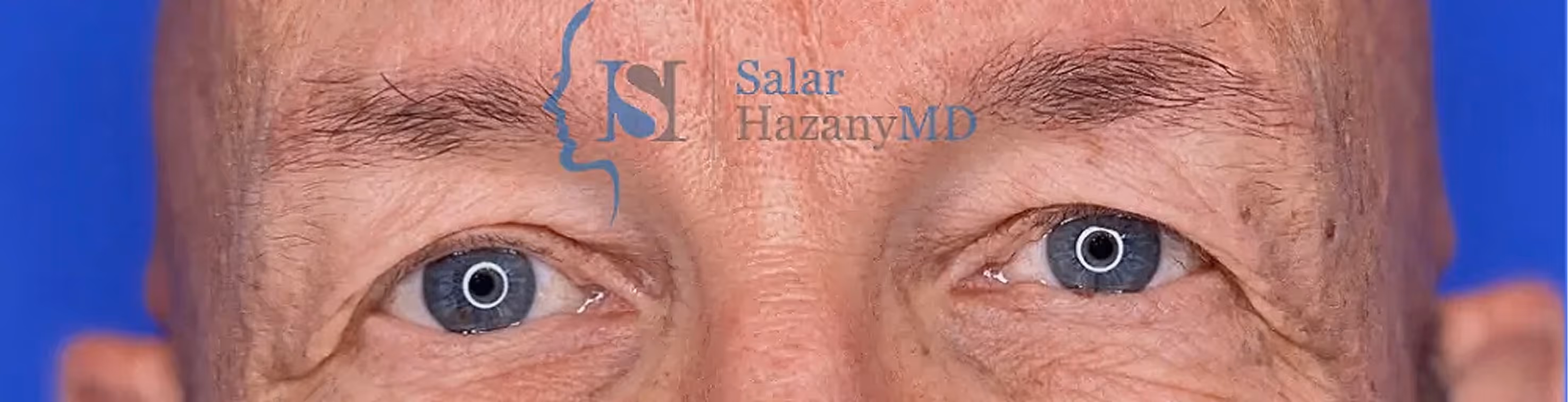 Close-up of an older man's blue eyes with visible wrinkles and blue background.