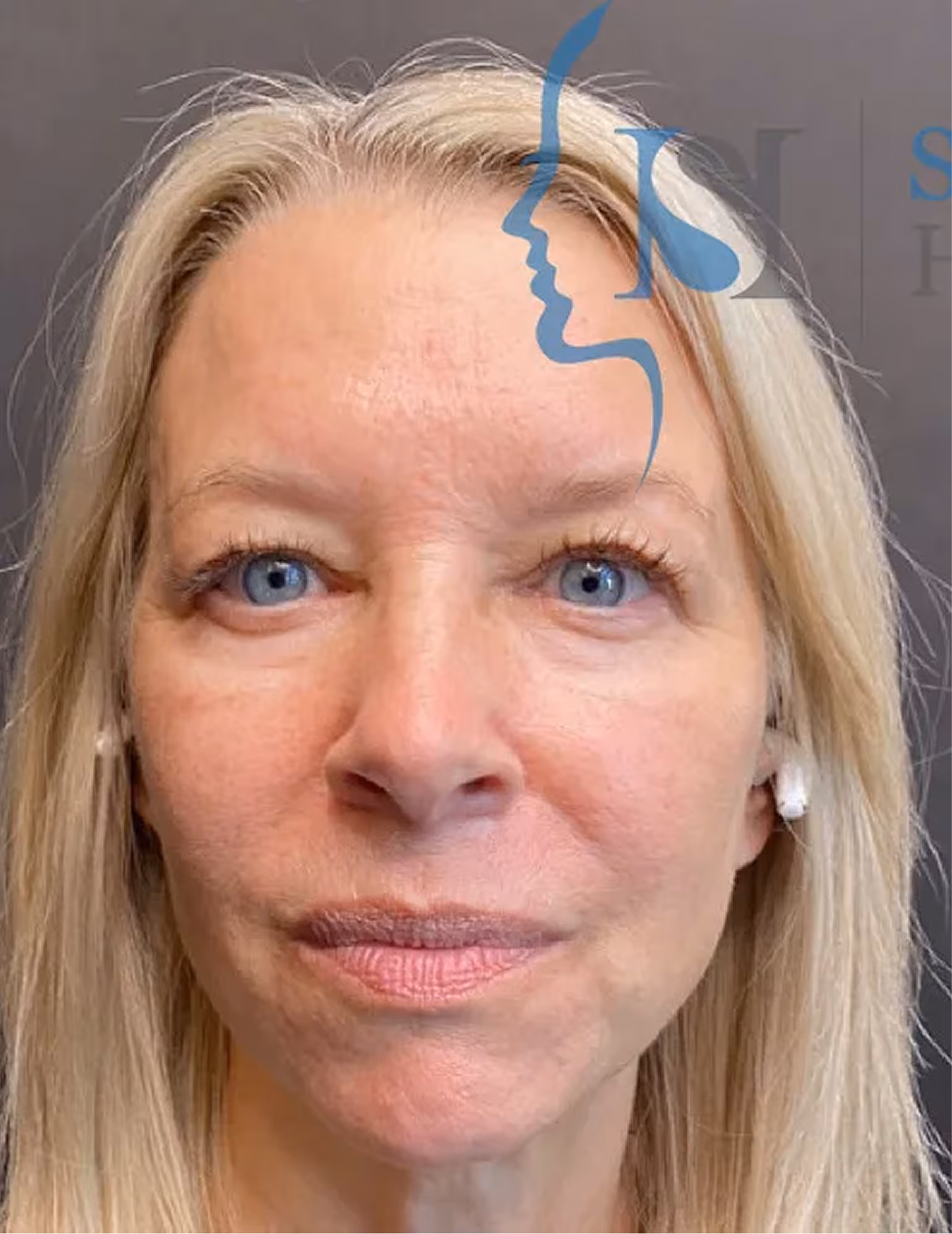 Close-up of a woman with blonde hair and blue eyes against a gray background with a blue logo overlapping.