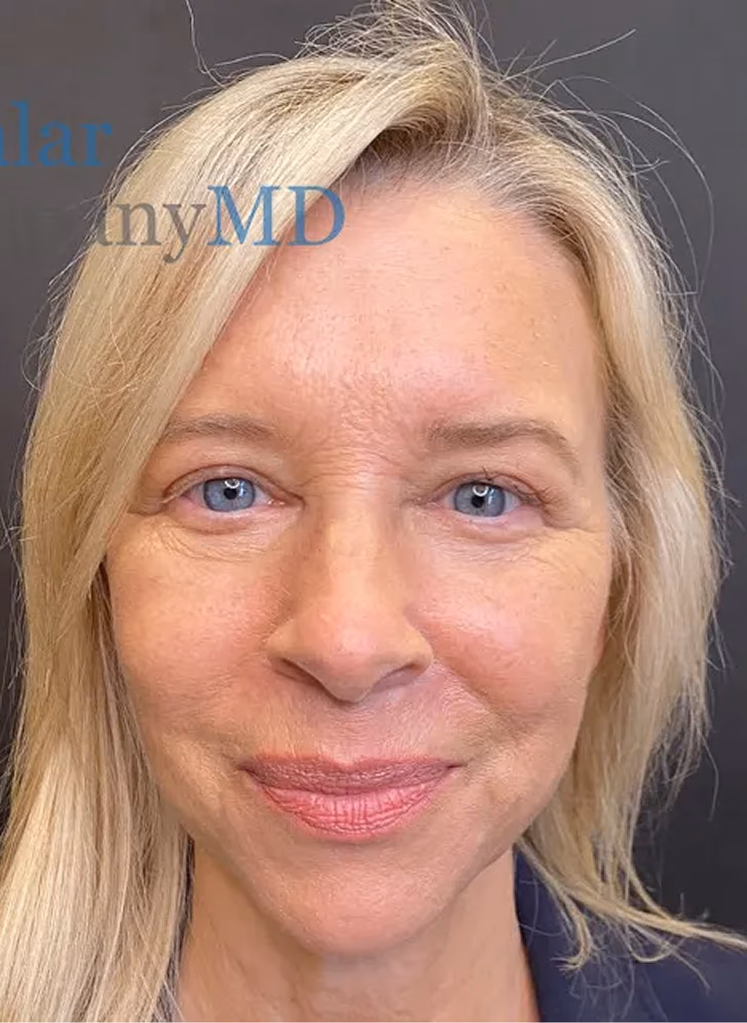 Smiling middle-aged woman with blonde hair and blue eyes against a dark background.