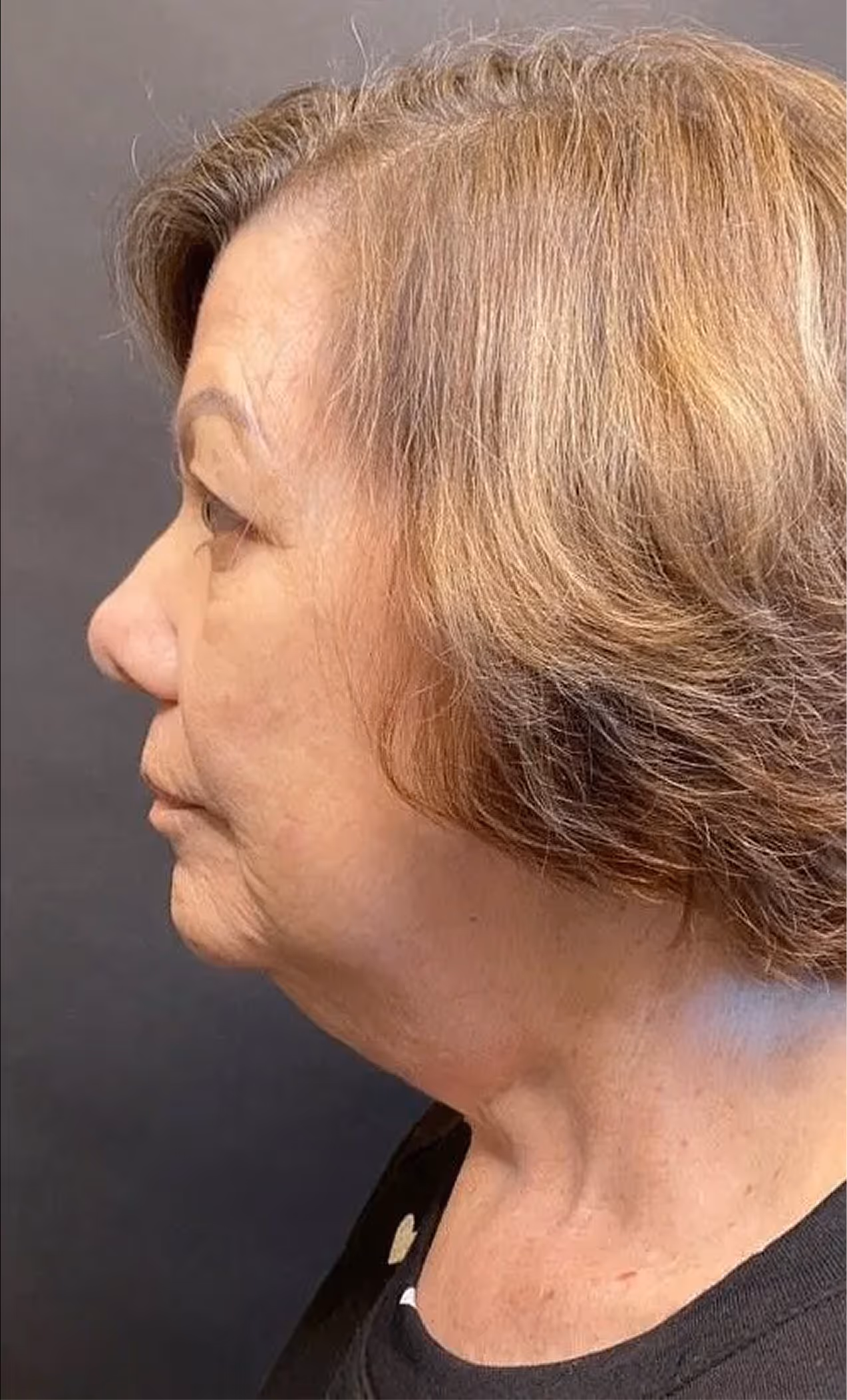 Profile of an older woman with short light brown hair against a dark background.