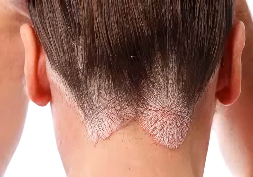 Close-up of a man's neck with a unique haircut design at the nape blending into short hair.