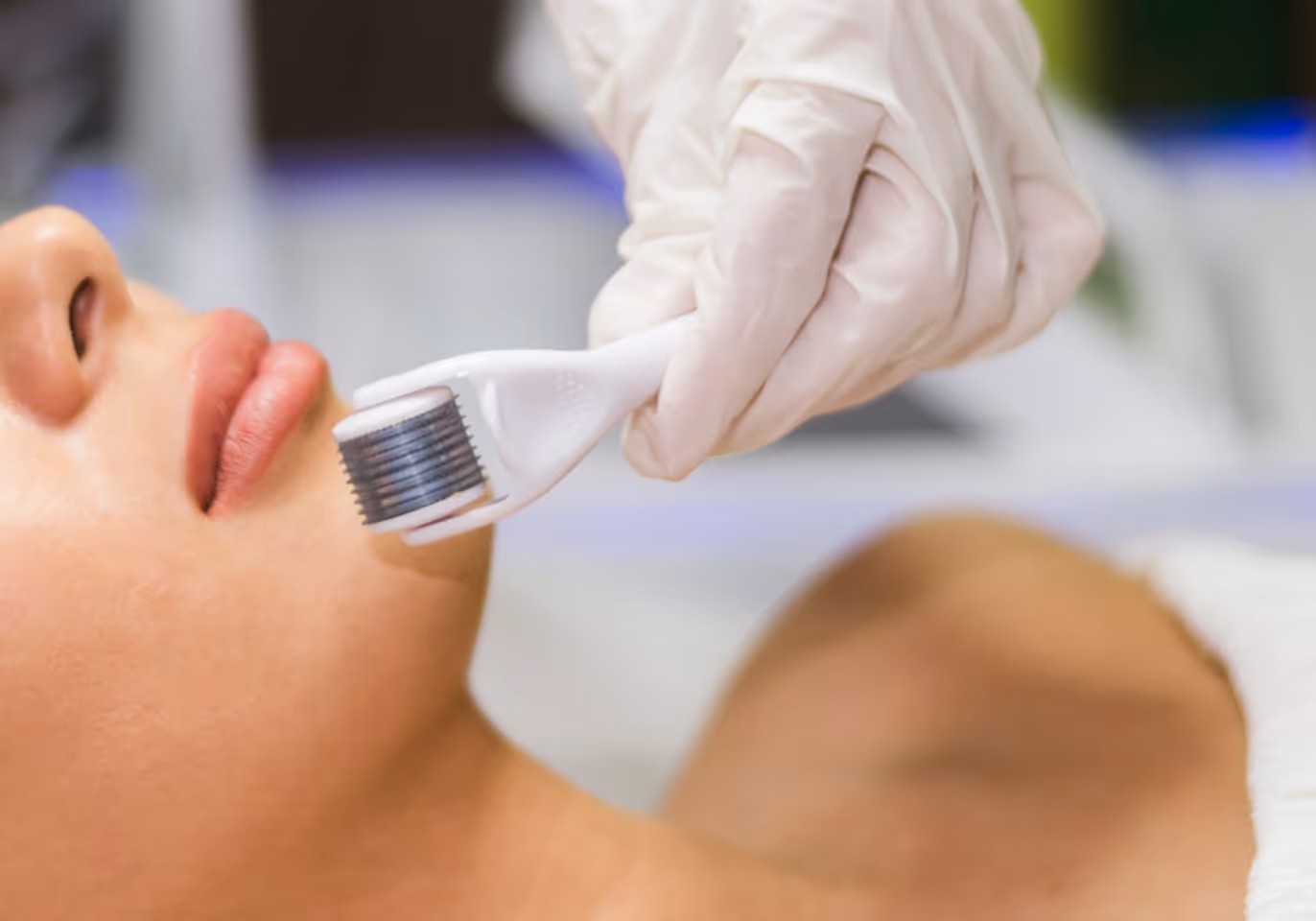 Close-up of a gloved hand using a microneedling roller on a person's cheek near the lips.