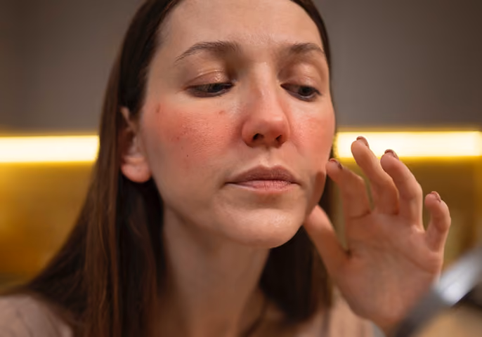 Close-up of a woman examining her face with redness on her cheeks and nose in warm indoor lighting.