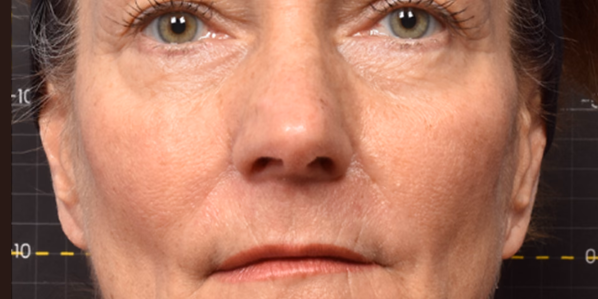 Close-up of a middle-aged person's face with green eyes, subtle wrinkles, and natural skin texture against a dark background with faint grid and yellow line markings.
