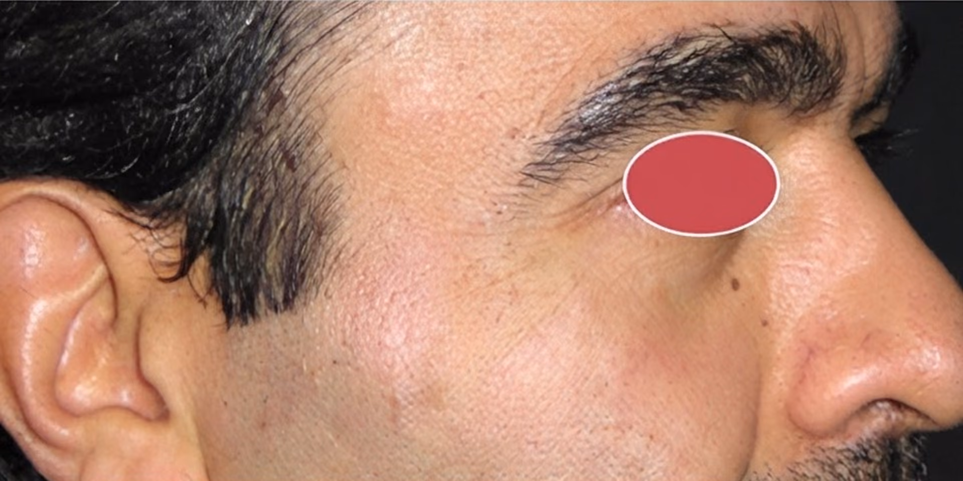 Close-up side profile of a man's face with short black hair, visible ear, and a red oval obscuring the eye area.