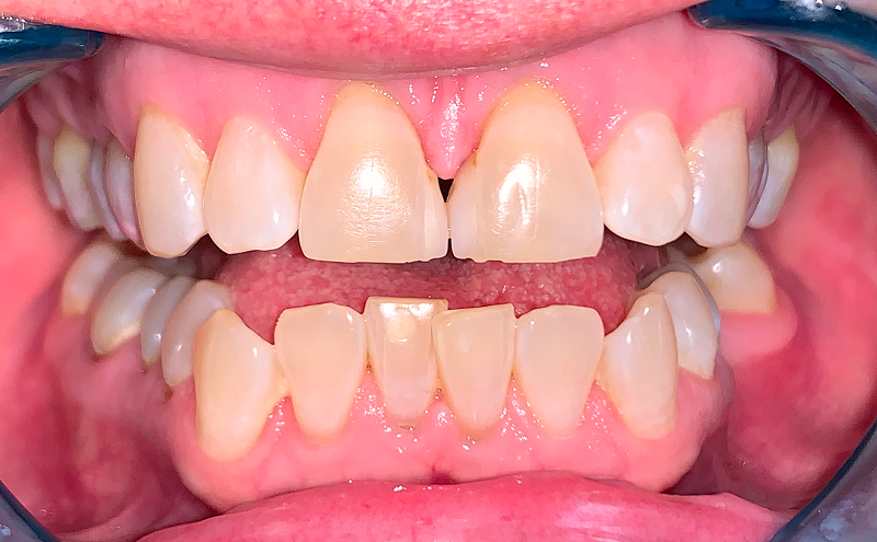 Before Image