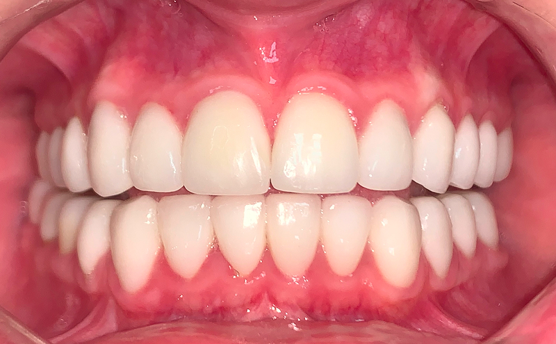 After Image