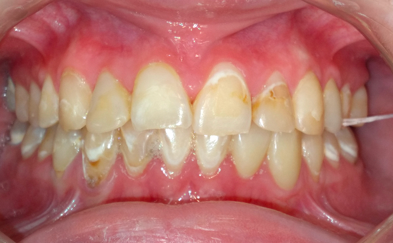 Before Image
