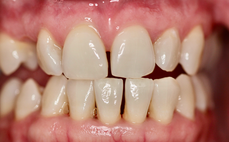 Before Image