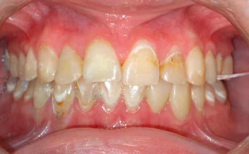 Before Image
