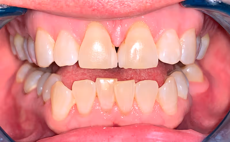 Before Image