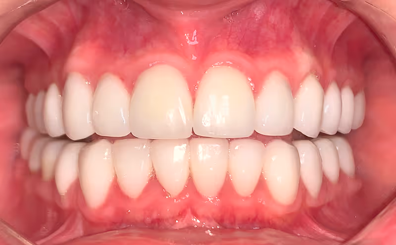 After Image