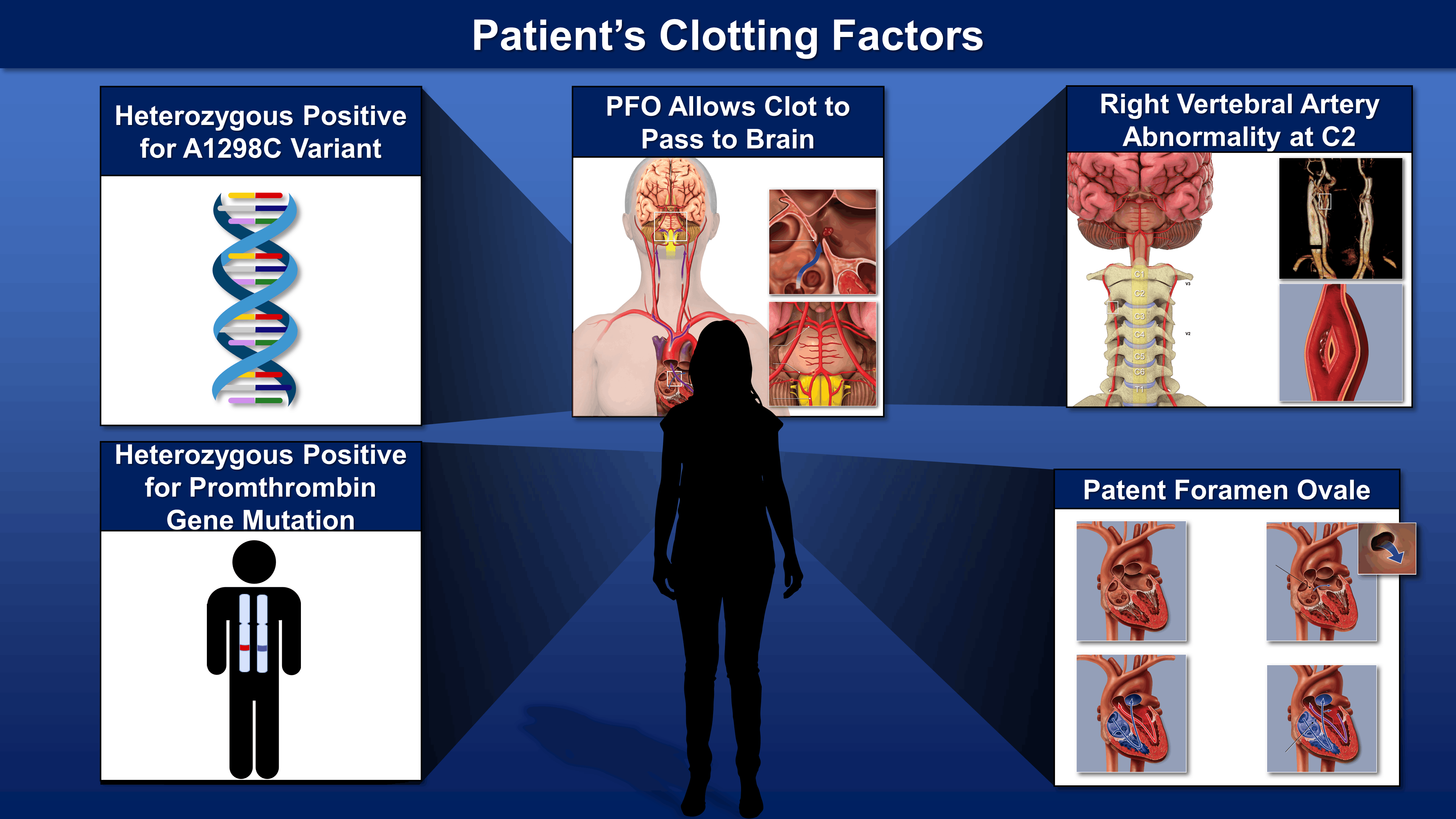 Clotting Factors Medical Presentation