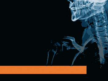 Anatomy of Medical Malpractice