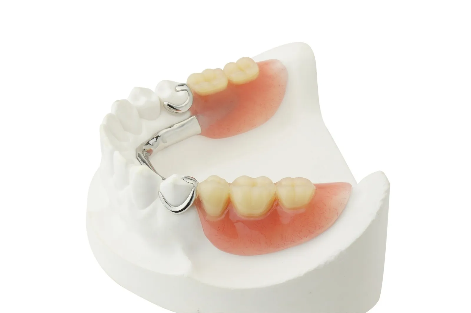 Partial Dentures treatment at Clarendon Dental Spa in Leeds
