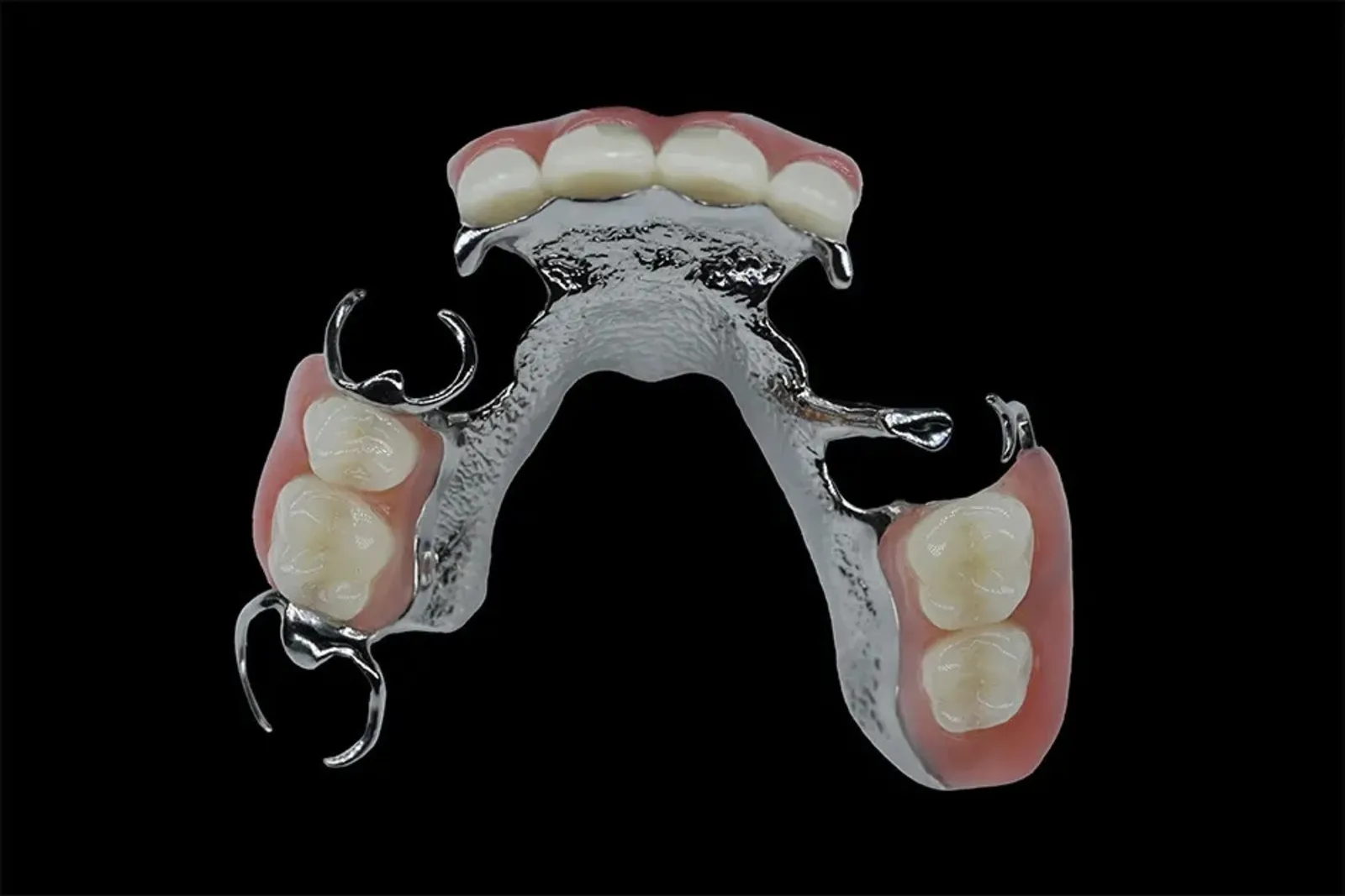 Slim cobalt chrome framework denture at Clarendon Dental Spa in Leeds