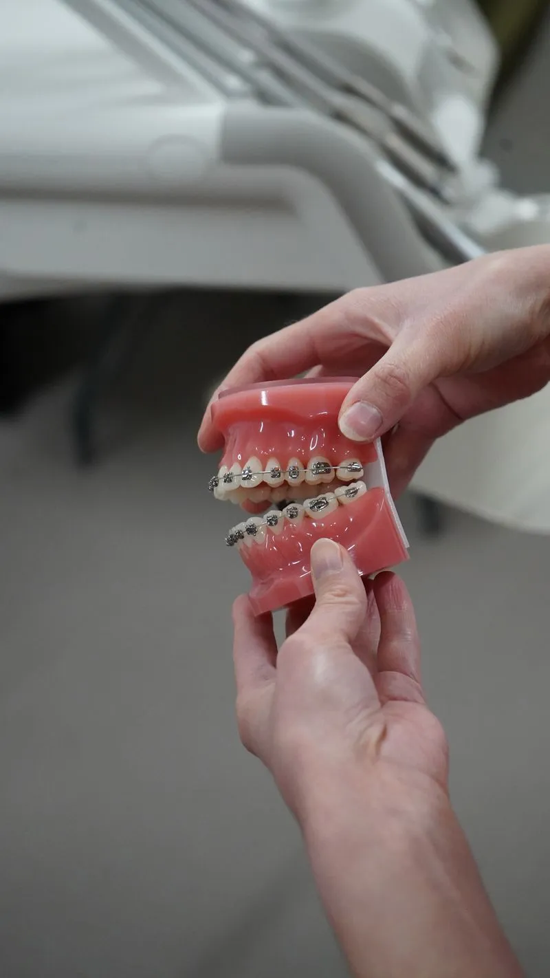 Fixed and removable teeth retainers at Clarendon Dental Spa in Leeds
