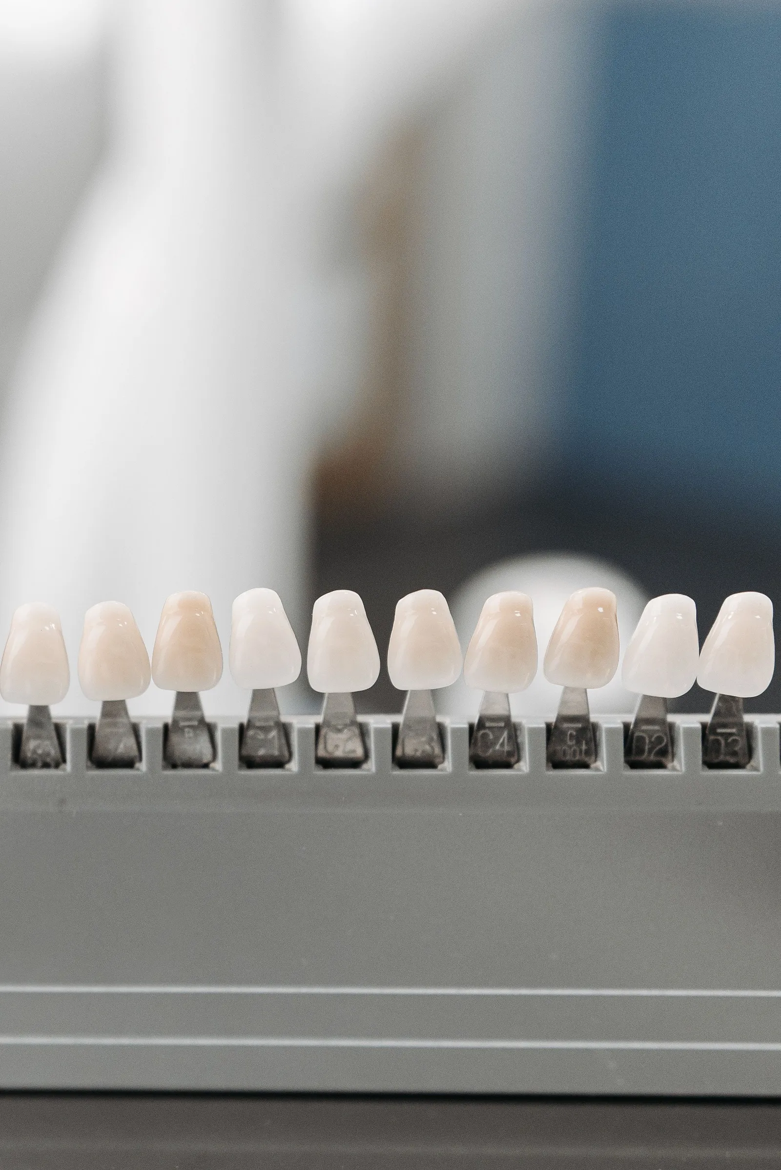 Natural tooth-coloured white filling at Clarendon Dental Spa in Leeds