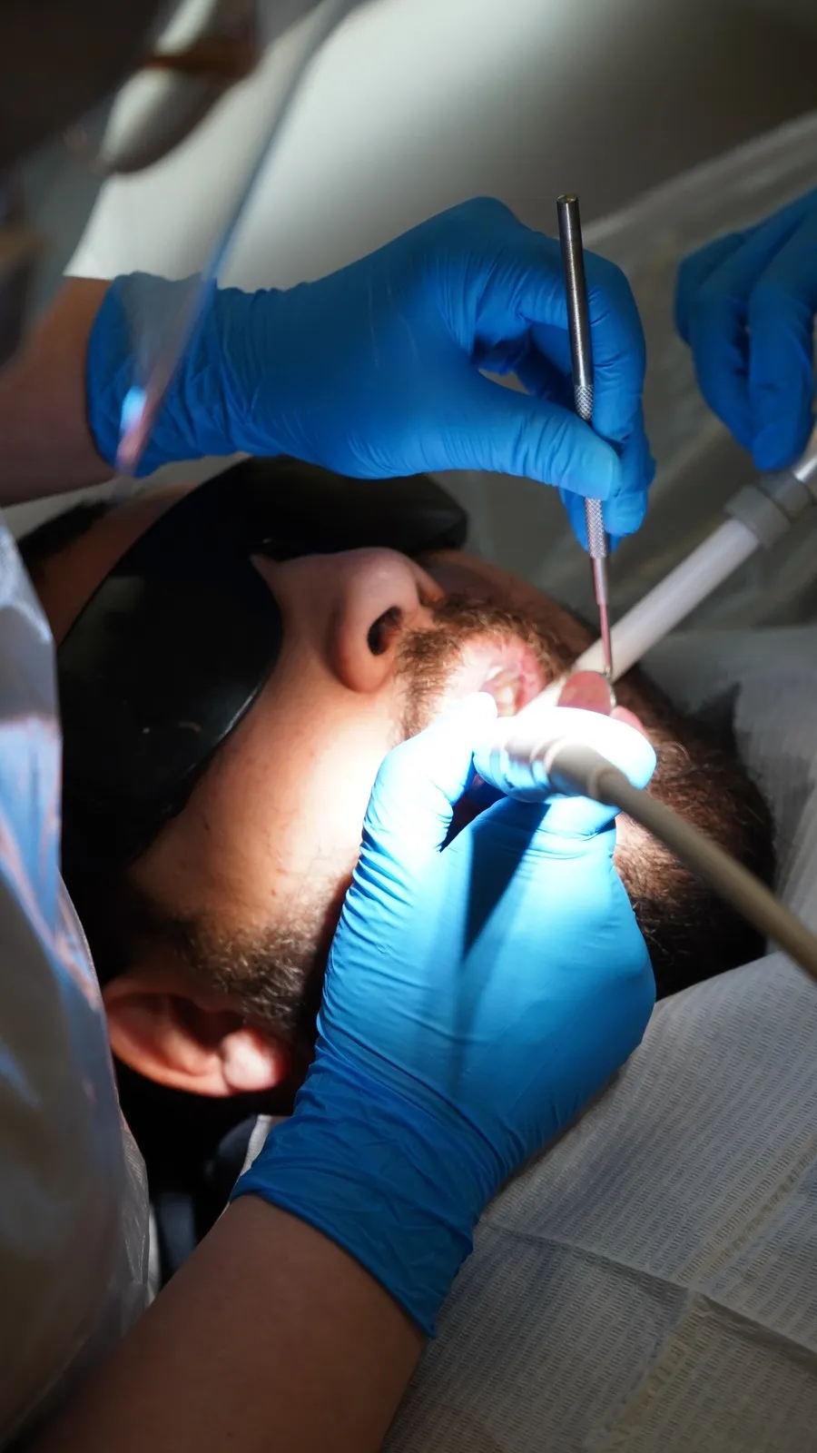 Implant Dentures treatment at Clarendon Dental Spa in Leeds