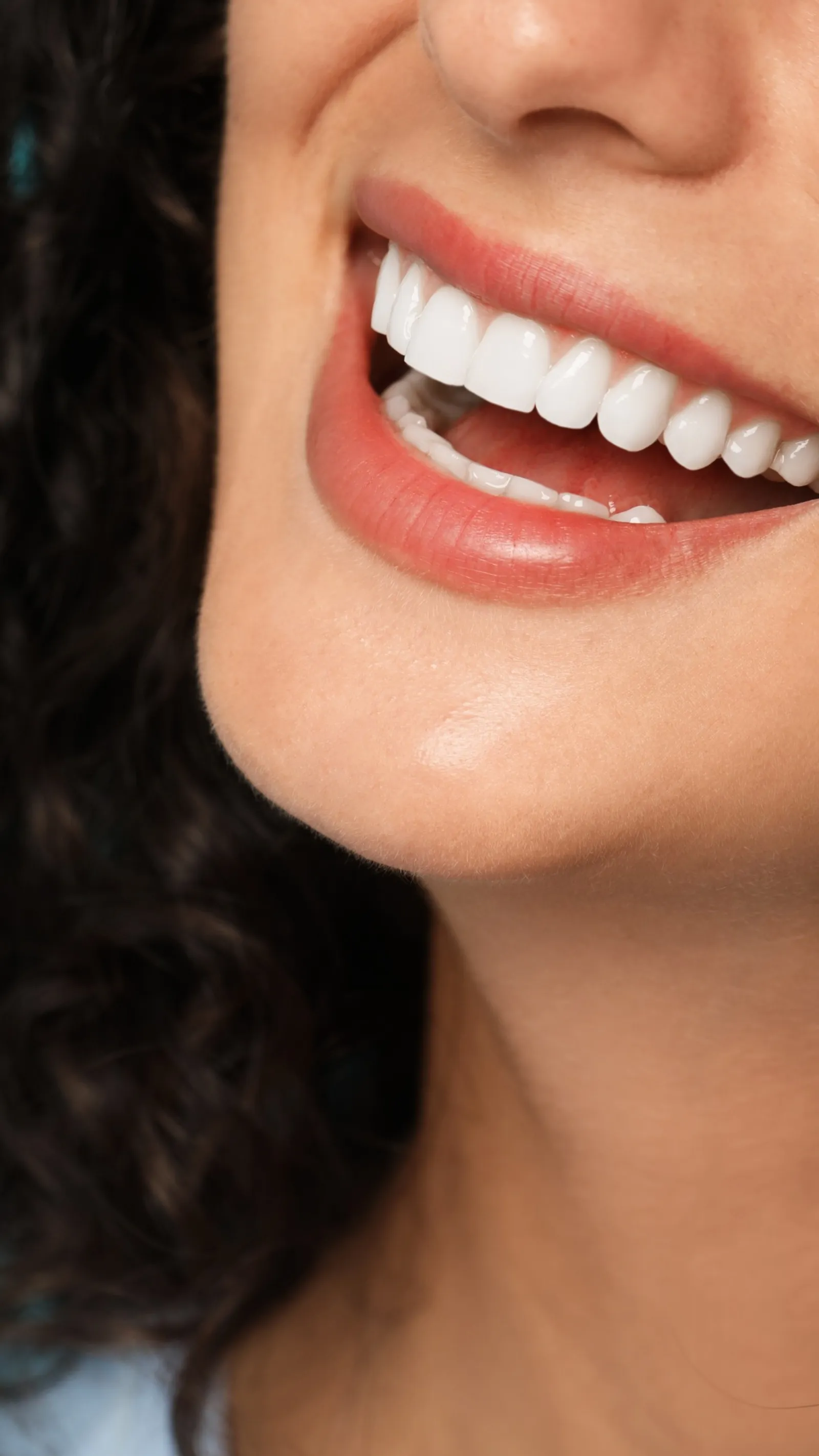 Teeth whitening before a wedding or event in Leeds at Clarendon Dental Spa