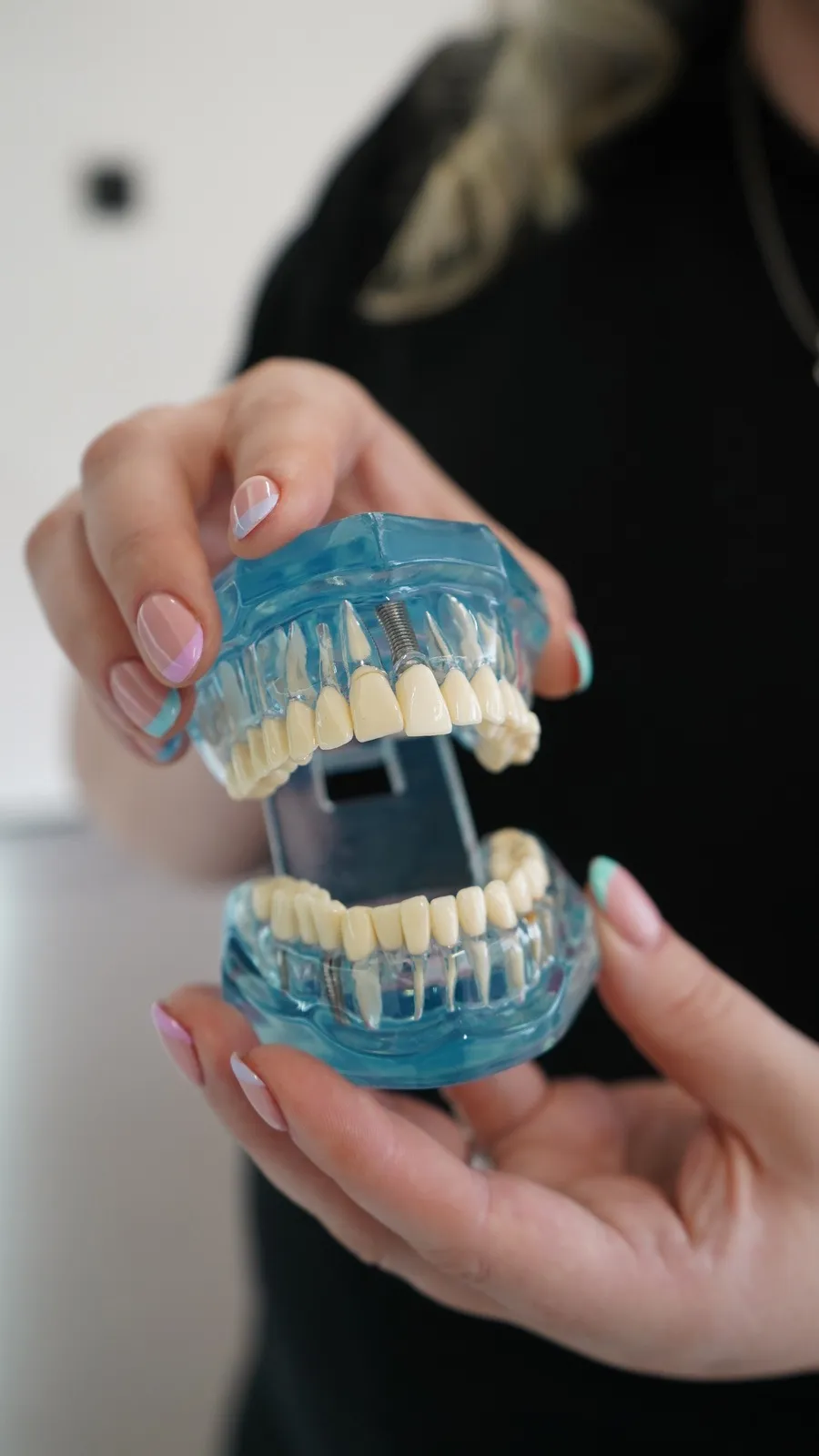 Broken, chipped or knocked-out tooth repair at Clarendon Dental Spa in Leeds