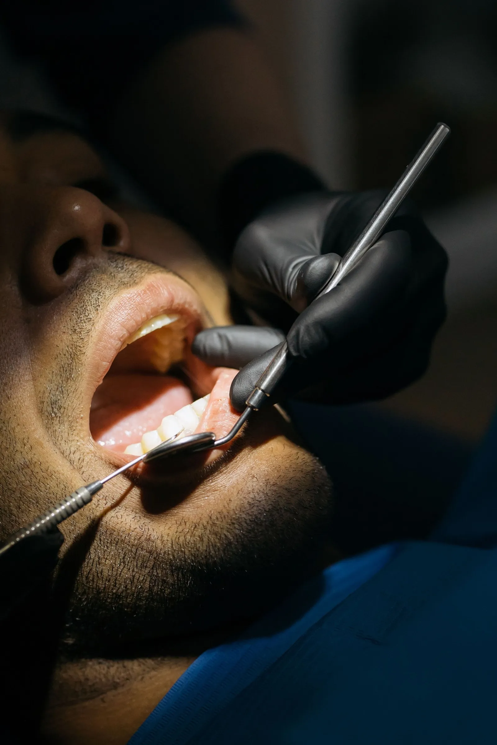 Cosmetic-standard emergency dental repairs at Clarendon Dental Spa in Leeds