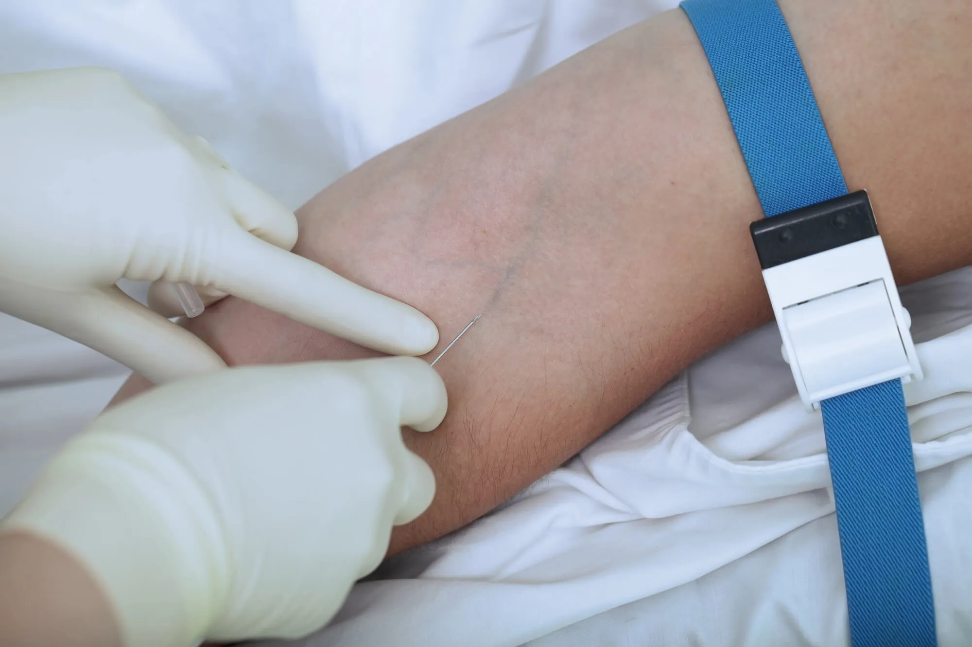 IV sedation dentist Franklin performs IV sedation