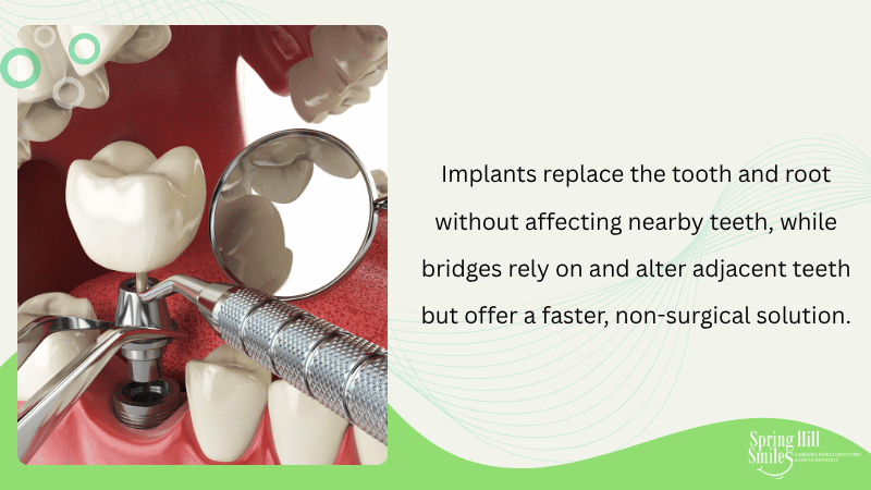 Key Differences Between Implants and Dental Bridges