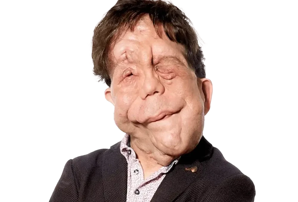 Adam Pearson, Speaker, Award-Winning Disability Advocate, Actor, Presenter, TV Host