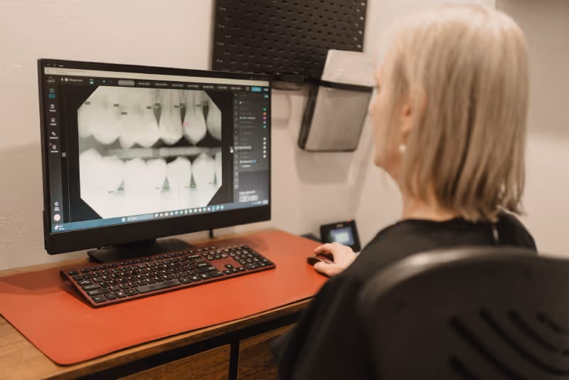 Person viewing dental X-rays on a computer screen at a desk with keyboard and mouse.