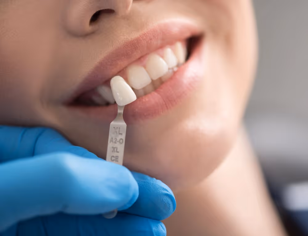 Same-day crowns and restorations