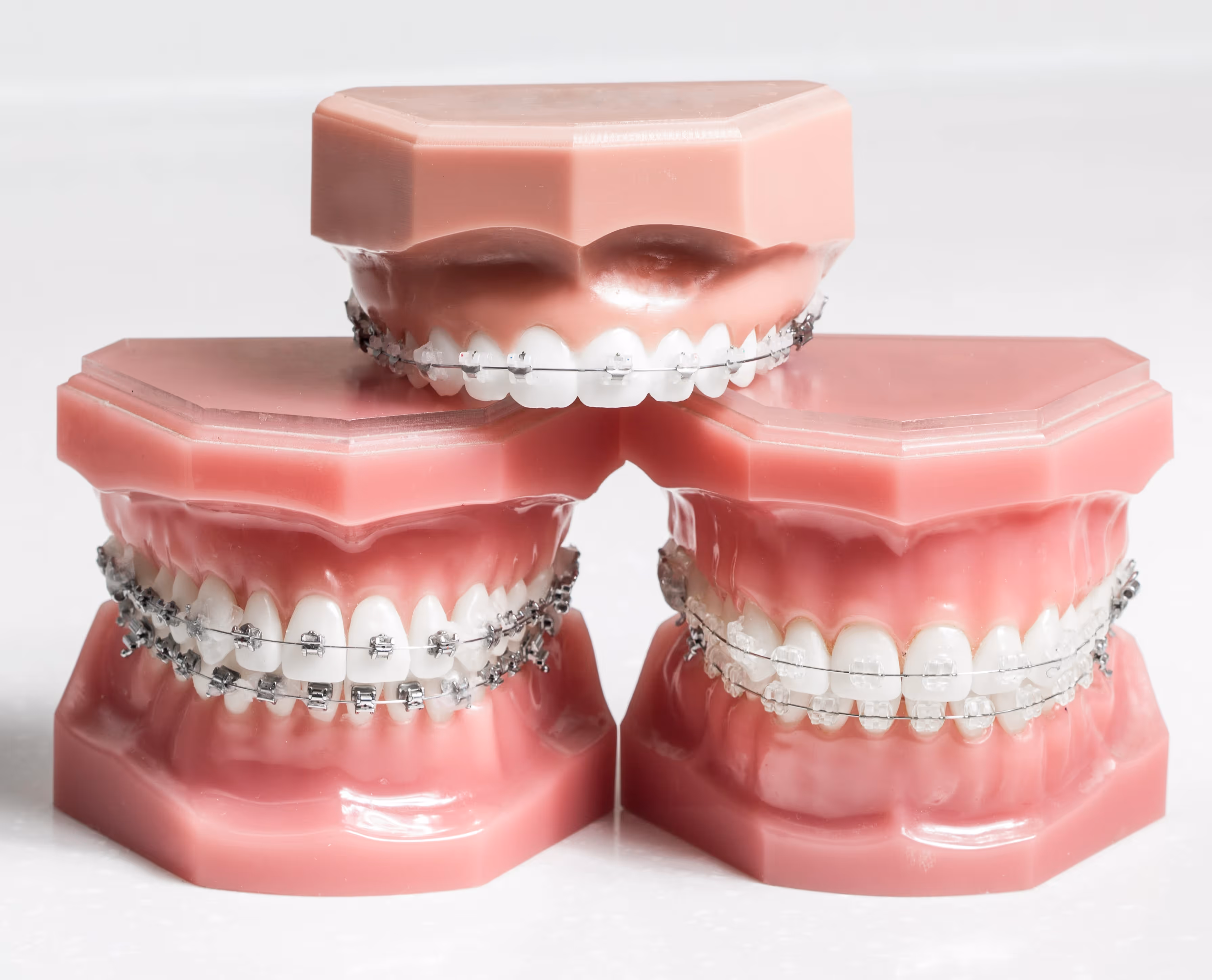 Braces