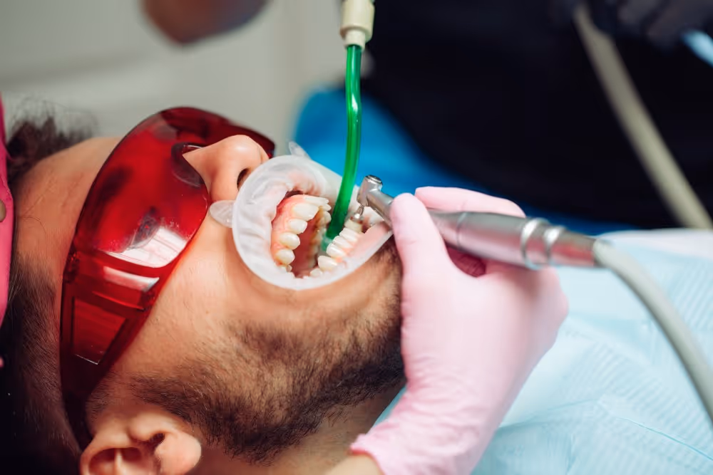 Dental cleanings