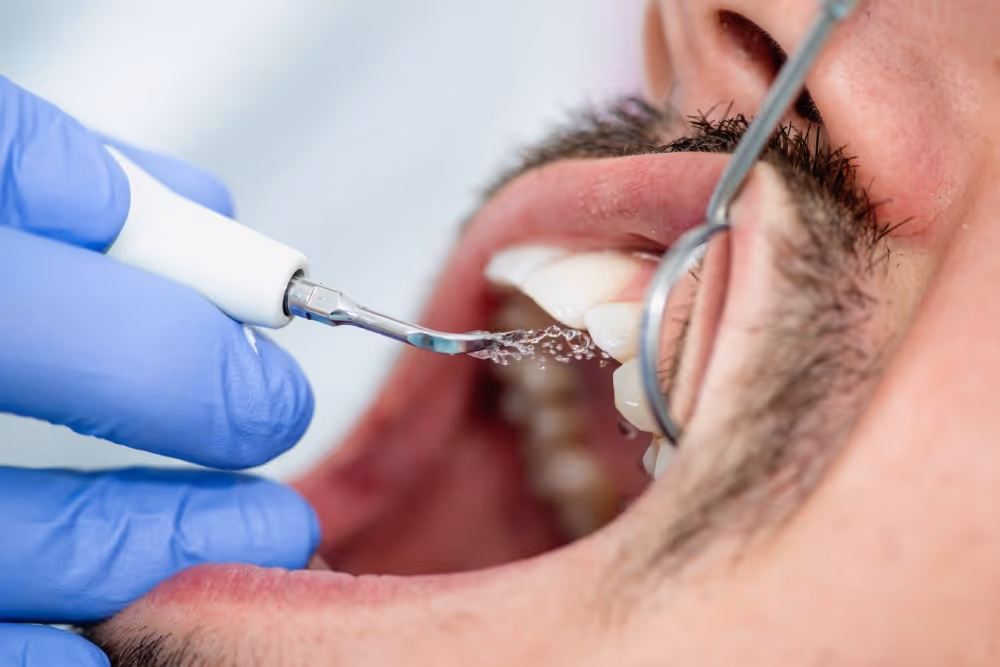 Periodontal care