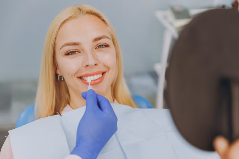 Veneers