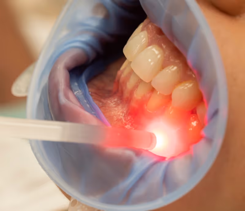 Laser therapy