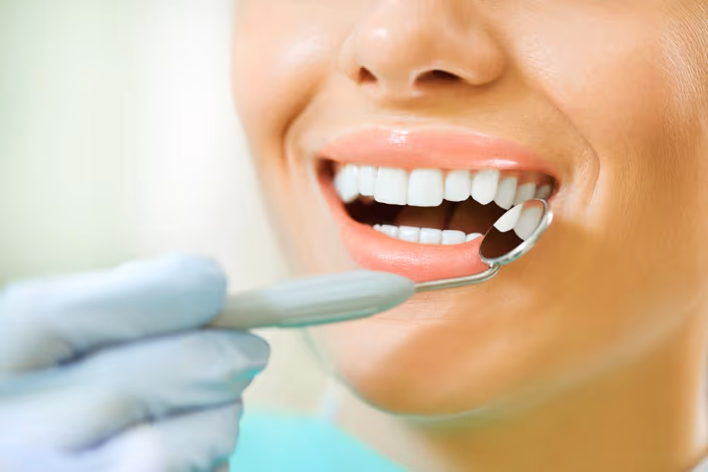 Teeth whitening