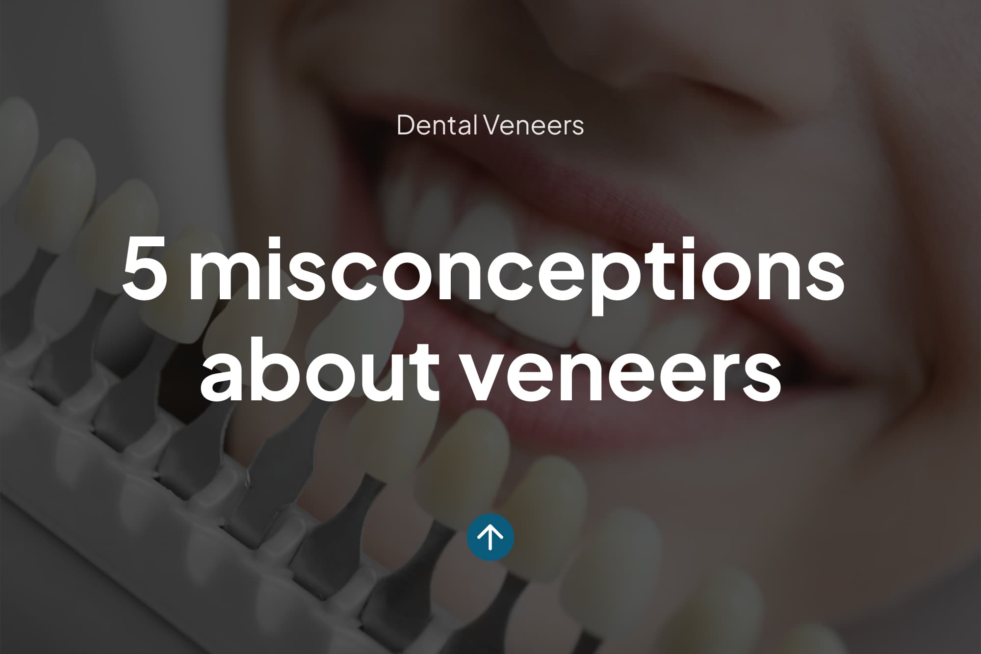 5 Common Misconceptions About Porcelain Veneers