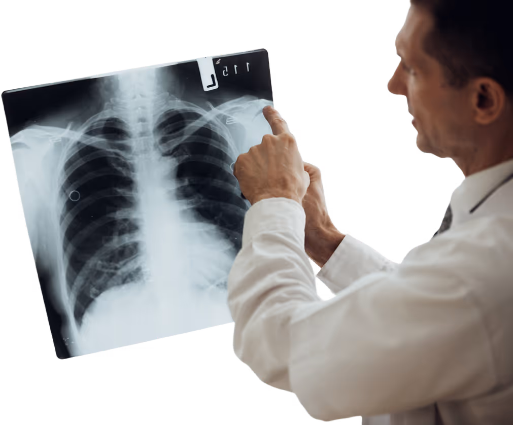 Doctor examining a chest X-ray image showing ribs and lungs.