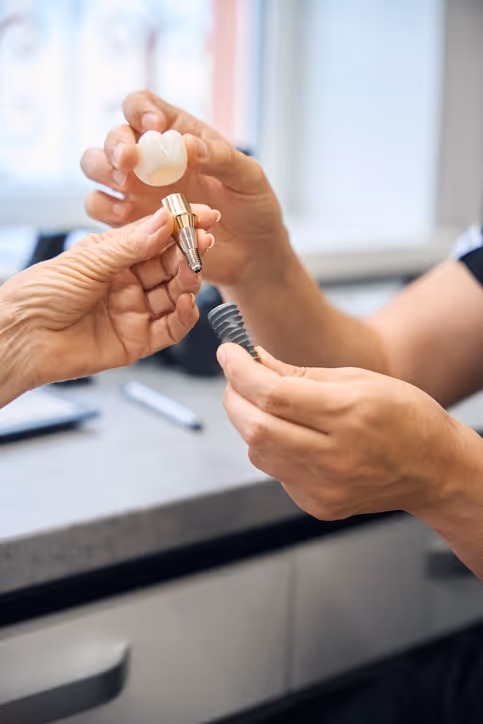 Close-up of hands holding dental implant components, including a crown, abutment, and implant screw.