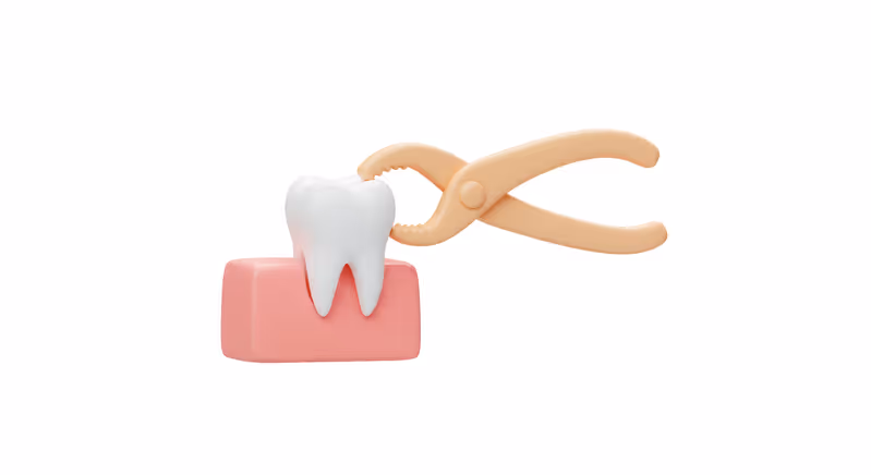 Illustration of dental pliers extracting a white tooth from pink gums.