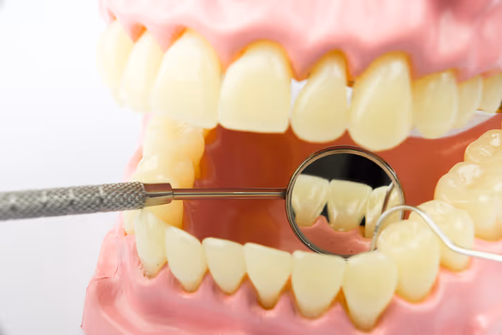 Dental model showing upper and lower teeth with a dental mirror reflecting lower teeth and a dental probe beside it.
