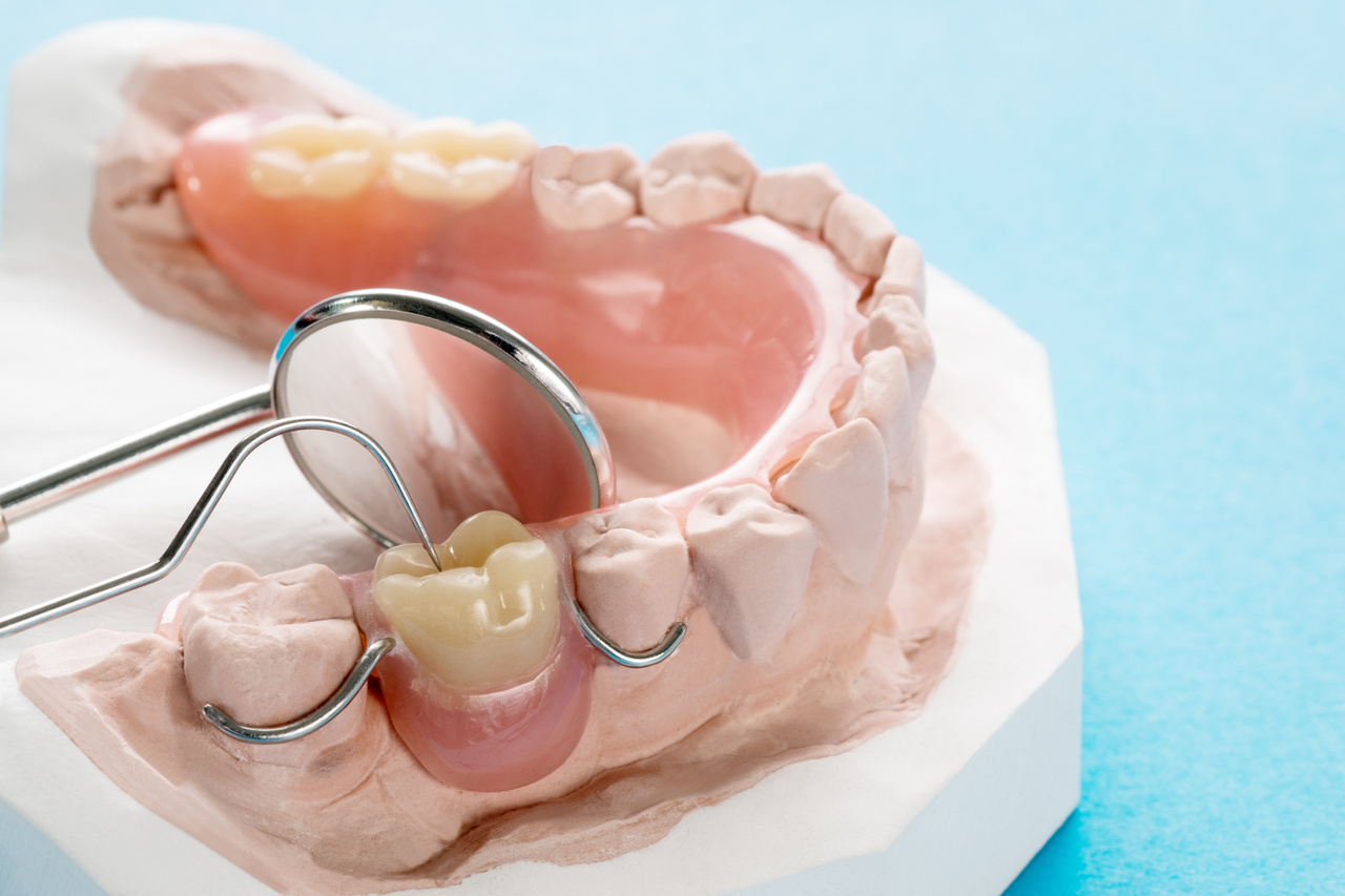 Full & Partial Dentures