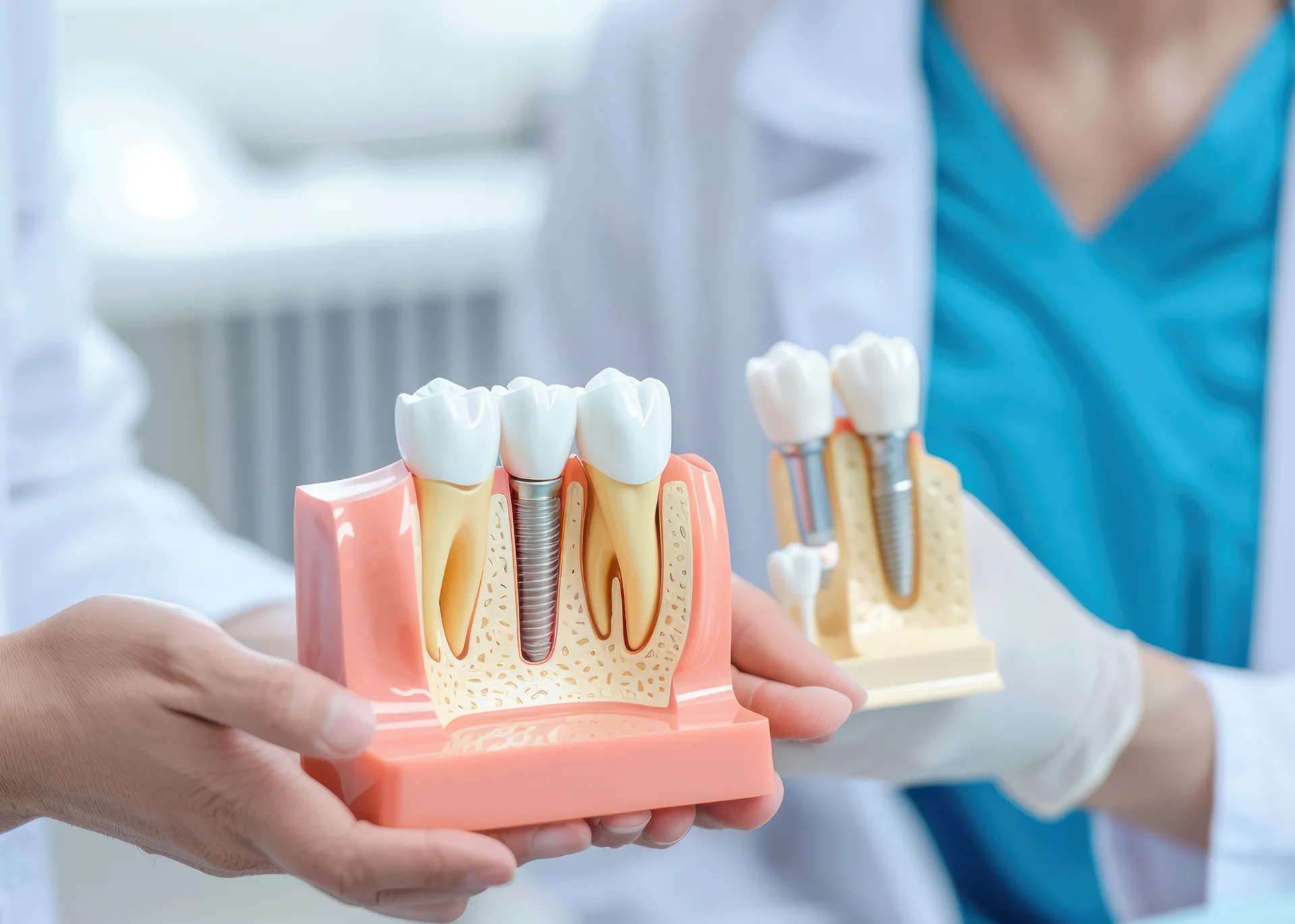 Model of dental implants held by medical professionals wearing white coats and gloves.