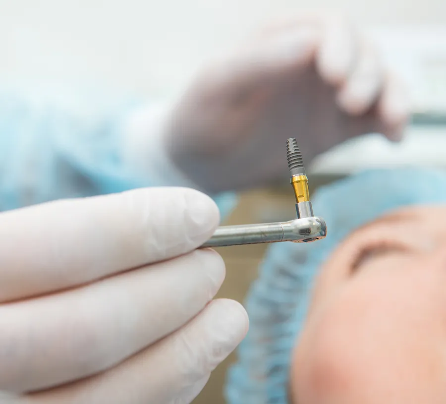 Gloved hand holding a dental implant tool with a dental implant near a person's face.