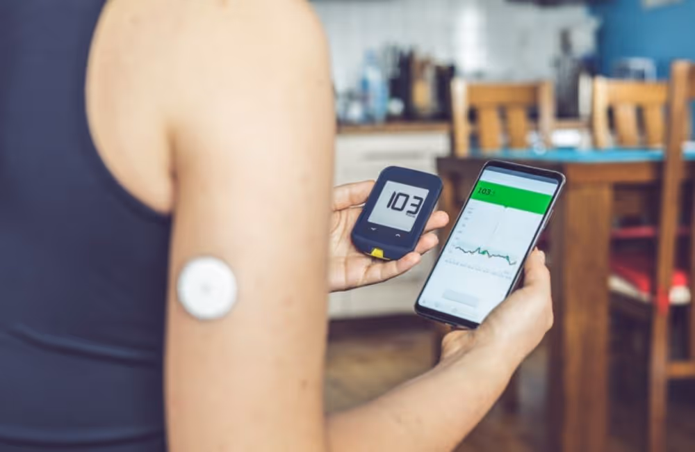 Rear shot of a woman monitoring her glucose levels through an app on a smartphone. Telemedicine allows doctors to monitor patient statuses remotely.